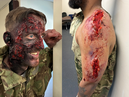 Two people in camouflage uniforms display realistic-looking special effects makeup simulating severe facial burns and deep arm wounds.